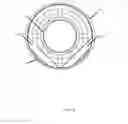 Fig. 12 - Displacer in magnetic resonance imaging system