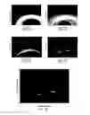 Fig. 08 - Motion tracking via body radio reflections