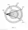 Fig. 16 - System and method for calibrating a PET scanner