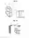 Fig. 07 - Image pickup unit for endoscope having multiple bonded frames