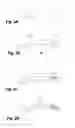 Fig. 04 - Process for manufacturing an ophthalmic lens equipped with an insert