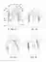 Fig. 04 - Rolling return to neutral depressable control