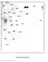 Fig. 09 - Methods of diagnosing and treating autism