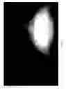 Fig. 08 - Vehicle vision system with detection enhancement using light control