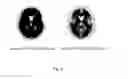 Fig. 04 - ROI setting technique for imaging test of living body