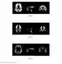 Fig. 05 - ROI setting technique for imaging test of living body