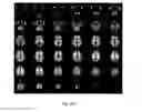 Fig. 06 - ROI setting technique for imaging test of living body