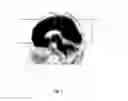 Fig. 09 - ROI setting technique for imaging test of living body