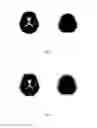 Fig. 10 - ROI setting technique for imaging test of living body
