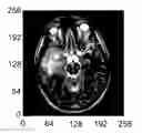 Fig. 01 - Determining local spectrum at a pixel using a rotationally invariant S-transform (RIST)