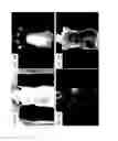 Fig. 10 - Methods and systems for assessing healing of tissue