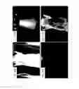 Fig. 11 - Methods and systems for assessing healing of tissue