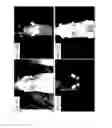 Fig. 12 - Methods and systems for assessing healing of tissue