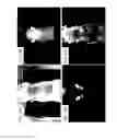 Fig. 13 - Methods and systems for assessing healing of tissue