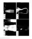 Fig. 14 - Methods and systems for assessing healing of tissue