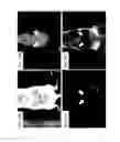 Fig. 15 - Methods and systems for assessing healing of tissue