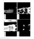 Fig. 16 - Methods and systems for assessing healing of tissue
