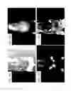 Fig. 17 - Methods and systems for assessing healing of tissue