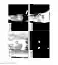 Fig. 19 - Methods and systems for assessing healing of tissue