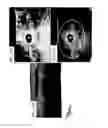 Fig. 22 - Methods and systems for assessing healing of tissue