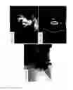 Fig. 23 - Methods and systems for assessing healing of tissue