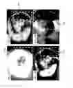 Fig. 25 - Methods and systems for assessing healing of tissue