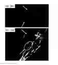 Fig. 27 - Methods and systems for assessing healing of tissue
