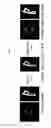 Fig. 14 - Method for forming 3D maxillofacial model by automatically segmenting medical image, automatic image segmentation and model formation server performing the same, and storage medium storing the same