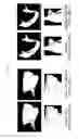 Fig. 17 - Method for forming 3D maxillofacial model by automatically segmenting medical image, automatic image segmentation and model formation server performing the same, and storage medium storing the same