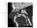 Fig. 01 - Indication-dependent display of a medical image