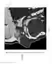 Fig. 03 - Indication-dependent display of a medical image