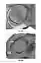 Fig. 20 - System and method for valve quantification