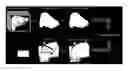 Fig. 01 - REGISTRATION OF VIDEO CAMERA WITH MEDICAL IMAGING