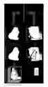 Fig. 03 - REGISTRATION OF VIDEO CAMERA WITH MEDICAL IMAGING