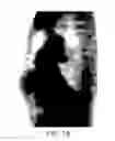 Fig. 03 - Determining PET scanning time