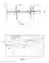 Fig. 04 - System for determining conicity of a wheel based on measured vibrations