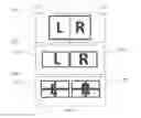 Fig. 04 - STEREO 3D HEAD MOUNTED DISPLAY APPLIED AS A LOW VISION AID