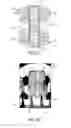 Fig. 06 - Semiconductor device replacement metal gate with gate cut last in RMG