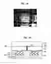 Fig. 14 - LIGHT EMITTING DIODE HAVING VERTICAL TOPOLOGY AND METHOD OF MAKING THE SAME