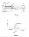 Fig. 05 - Systems, devices, and methods for electric power generation from vocal folds vibrations