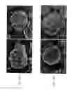 Fig. 02 - Negative electrode active material for lithum ion rechargeable battery and negative electrode using the same