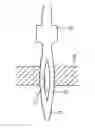 Fig. 01 - PRESS-FIT TERMINAL