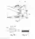 Fig. 03 - Conveyance member removal method and device
