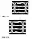Fig. 17 - Method for automatically finding the optimum sampling point in an eye diagram