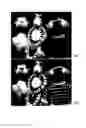 Fig. 01 - Systems, Methods, and Media for Recording an Image Using an Optical Diffuser