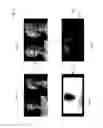 Fig. 25 - Method of converting 2D video to 3D video using machine learning