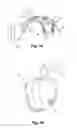 Fig. 02 - Hearing aid device with integrated antenna