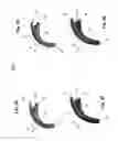 Fig. 04 - Hearing aid device with integrated antenna
