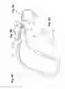 Fig. 09 - Hearing aid device with integrated antenna