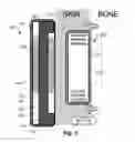 Fig. 04 - Bone conduction transducer system with adjustable retention force